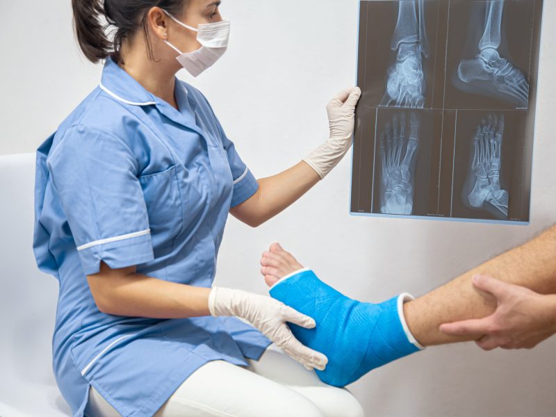 Female doctor in a blue medical gown checking broken leg and shows the male patient lateral projection x-ray of foot and ankle.